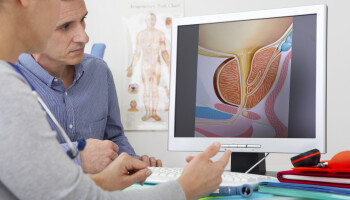 Rak prostate